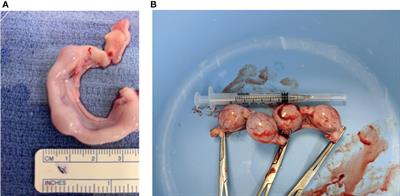 Corticotropin releasing hormone is present in the feline placenta and maternal serum